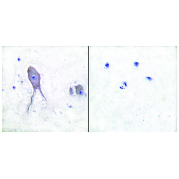 Anti-NOTCH2 (Cleaved-Asp¹⁷³³) antibody produced in rabbit，100UG，SAB4502020-100UG，Sigma