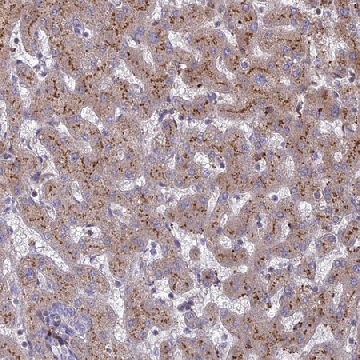 Anti-ST3GAL6 antibody produced in rabbit，100UL，HPA018792-100UL，Sigma