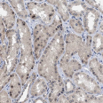 Anti-NUP93 antibody produced in rabbit，100UL，HPA017937-100UL，Sigma