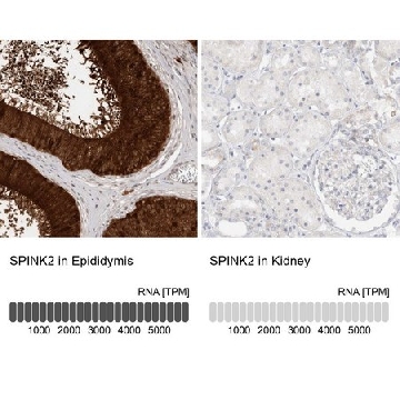 Anti-SPINK2 antibody produced in rabbit，100UL，HPA026813-100UL，Sigma