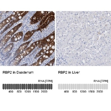 Anti-RBP2 antibody produced in rabbit，100UL，HPA035866-100UL，Sigma