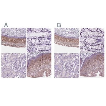 Anti-SBSN antibody produced in rabbit，100UL，HPA067734-100UL，Sigma