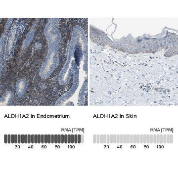 Anti-ALDH1A2 antibody produced in rabbit，100UL，HPA010022-100UL，Sigma