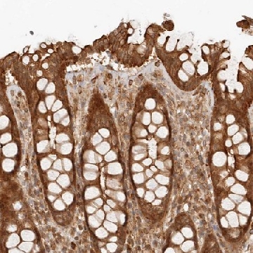Anti-UFSP1 antibody produced in rabbit，100UL，HPA027099-100UL，Sigma
