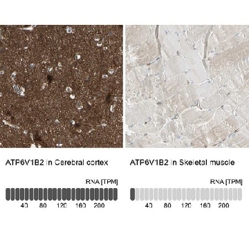 Anti-ATP6V1B2 antibody produced in rabbit，100UL，HPA008147-100UL，Sigma