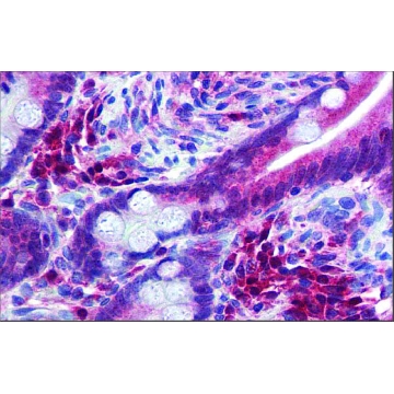 Anti-TRIM35 antibody produced in rabbit，100UL，SAB2103161-100UL，Sigma