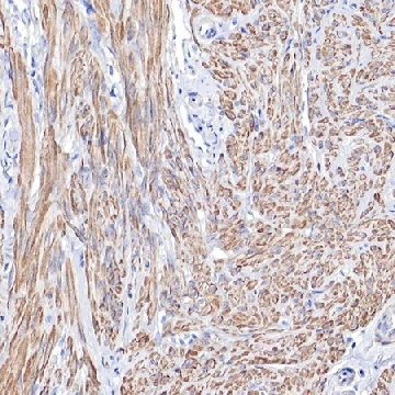 Anti-TPM1 antibody produced in rabbit，100UL，HPA000261-100UL，Sigma