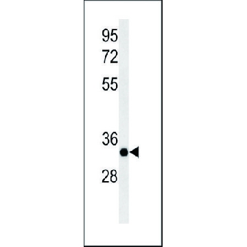 ANTI-ACER3 (C-TERM) antibody produced in rabbit，400UL，SAB1303797-400UL，Sigma