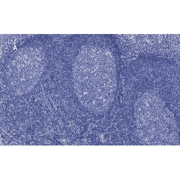 Anti-CD45 Antibody, clone 5L3, ZooMAb® Rabbit Monoclonal，4X25UL，ZRB1180-4X25UL，Sigma