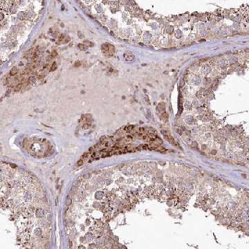 Anti-PSTK antibody produced in rabbit，100UL，HPA037781-100UL，Sigma