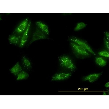 Monoclonal Anti-SQSTM1 antibody produced in mouse，100UG，WH0008878M1-100UG，Sigma
