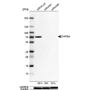 Anti-ZNF384 antibody produced in rabbit，100UL，HPA004051-100UL，Sigma