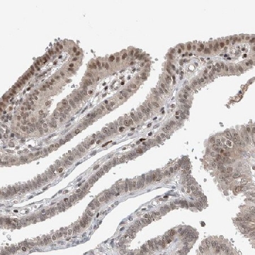 Anti-ZNF592 antibody produced in rabbit，100UL，HPA021600-100UL，Sigma