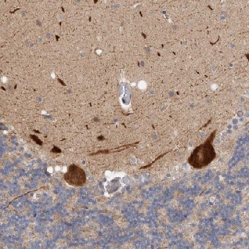 Anti-ZNF804B antibody produced in rabbit，100UL，HPA026702-100UL，Sigma