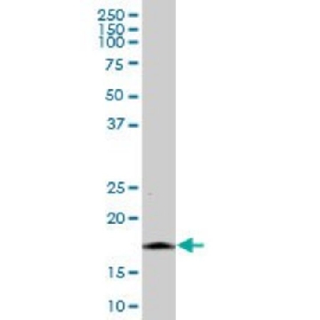 Anti-NINJ1 antibody produced in mouse，50UG，SAB1400186-50UG，Sigma
