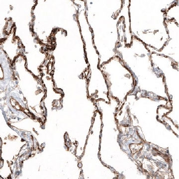 Anti-THBD antibody produced in rabbit，100UL，HPA002982-100UL，Sigma