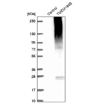 Anti-TMEM184B antibody produced in rabbit，100UL，HPA024076-100UL，Sigma