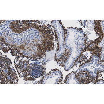 Anti-Fibrillin-1 Antibody, clone 6C19 ZooMAb® Rabbit Monoclonal，25UL，ZRB1019-25UL，Sigma