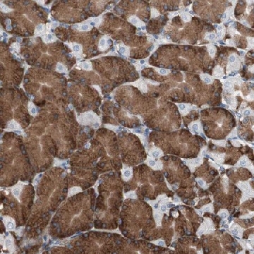 Anti-CALU antibody produced in rabbit，100UL，HPA006018-100UL，Sigma