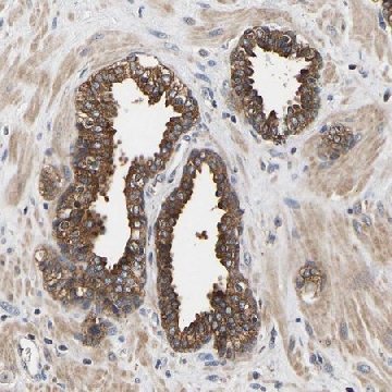 Anti-LRBA antibody produced in rabbit，100UL，HPA019366-100UL，Sigma