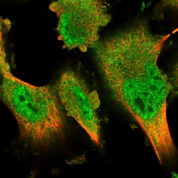 Anti-DYRK2 antibody produced in rabbit，100UL，HPA027230-100UL，Sigma