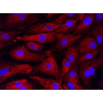 Anti-RS1 (66-78) antibody produced in rabbit，200UL，SAB1100315-200UL，Sigma