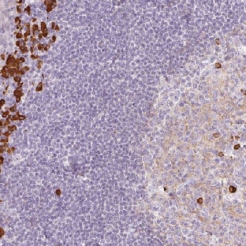 Anti-PRPF38B antibody produced in rabbit，100UL，HPA053255-100UL，Sigma