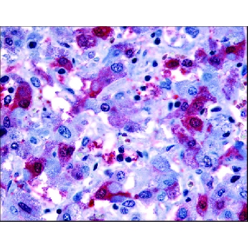 Anti-PTGFR antibody produced in rabbit，50UG，SAB2900625-50UG，Sigma