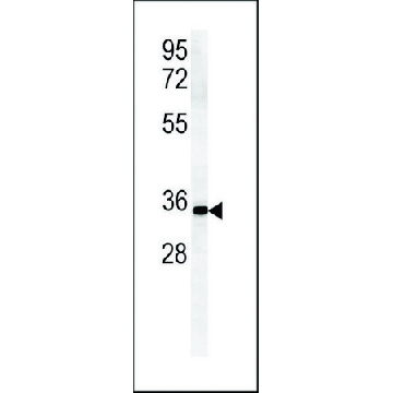 ANTI-ZDHC2 (N-TERMINAL) antibody produced in rabbit，400UL，SAB1306504-400UL，Sigma