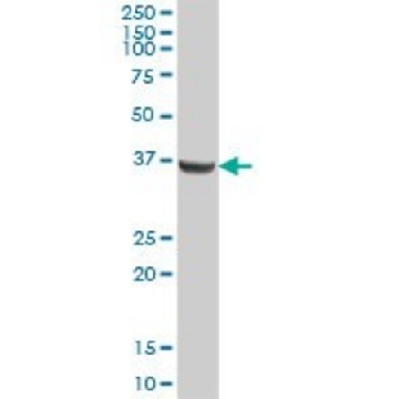 Anti-ALDOB antibody produced in mouse，50UG，SAB1409005-50UG，Sigma