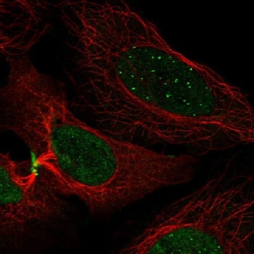 Anti-CENPC antibody produced in rabbit，100UL，HPA058252-100UL，Sigma