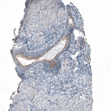 Anti-FGFR2 antibody produced in rabbit，100UL，HPA035305-100UL，Sigma