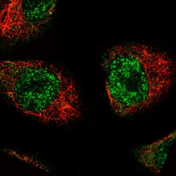Monoclonal Anti-MKL2 antibody produced in mouse，100UL，AMAB90887-100UL，Sigma