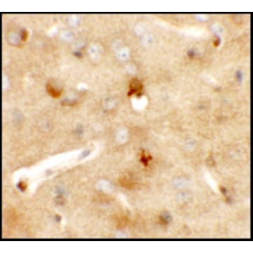 Anti-CCDC141 antibody produced in rabbit，100UG，SAB3500670-100UG，Sigma