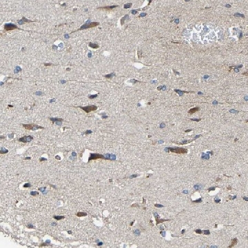 Anti-RHOT2 antibody produced in rabbit，100UL，HPA012624-100UL，Sigma