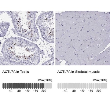 Anti-ACTL7A antibody produced in rabbit，100UL，HPA021624-100UL，Sigma