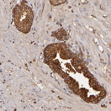 Anti-CFB antibody produced in rabbit，100UL，HPA001817-100UL，Sigma