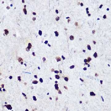 Anti-Phospho-Smad2-S465/467 + Smad3-S423/425 antibody produced in rabbit，100UL，SAB5700402-100UL，Sigma