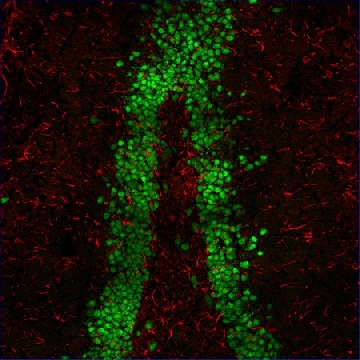 Anti-Guinea Pig IgG (H+L), highly cross-adsorbed, CF™555 antibody produced in donkey，250UL，SAB4600298-250UL，Sigma
