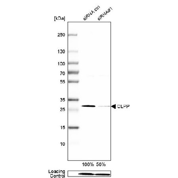 Anti-CLPP antibody produced in rabbit，100UL，HPA010649-100UL，Sigma