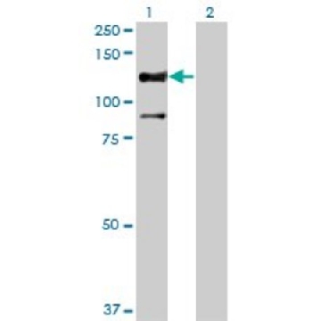 Monoclonal Anti-STK31, (C-terminal) antibody produced in mouse，100UG，SAB1402605-100UG，Sigma