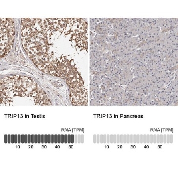 Anti-TRIP13 antibody produced in rabbit，100UL，HPA005727-100UL，Sigma