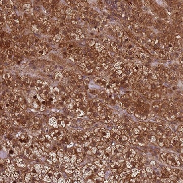 Anti-KIF26A antibody produced in rabbit，100UL，HPA046882-100UL，Sigma