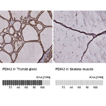 Monoclonal Anti-PDIA3 antibody produced in mouse，100UL，AMAB90988-100UL，Sigma