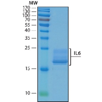 白介素 -6 人，10UG，SCU0001-10UG，Sigma