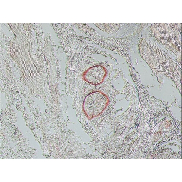 Monoclonal Anti-Nerve Growth Factor Receptor (NGFR p75) antibody produced in mouse，0.2ML，N5408-.2ML，Sigma