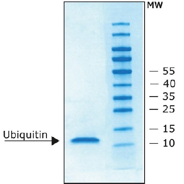 泛素 人，1MG，U5507-1MG，Sigma