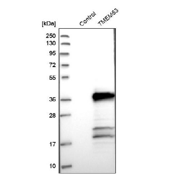 Anti-TMEM53 antibody produced in rabbit，100UL，HPA021134-100UL，Sigma