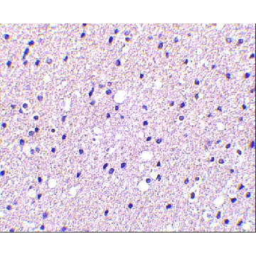 Anti-Presenilin1 antibody produced in rabbit，100UG，PRS4203-100UG，Sigma