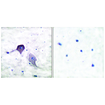 Anti-Presenilin 1 antibody produced in rabbit，100UG，SAB4502424-100UG，Sigma